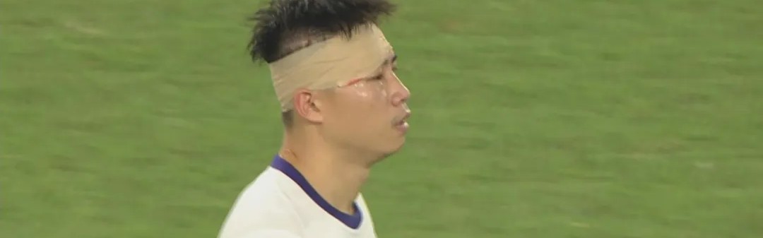 百家乐玩法-津媒：杨帆右眼眉骨受伤赛后缝针，王献钧两颗门牙直接被撞断